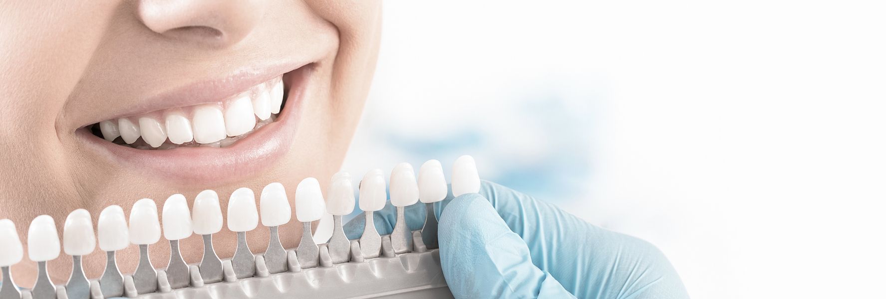 skala białości zębów u dentysty w Bielanach Wrocławskich, skuteczne wybielanie zębów u stomatologa na Bielanach Wrocławskich